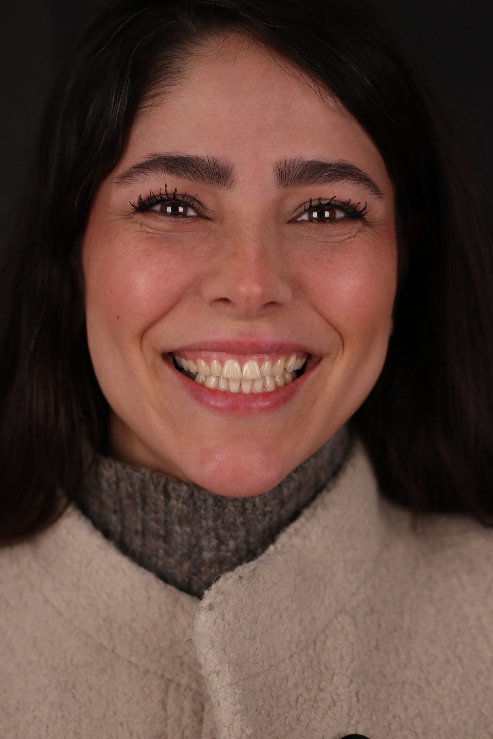before composite_0066