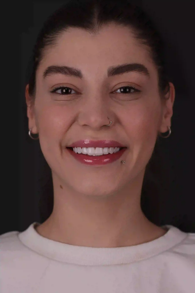 after composite 2