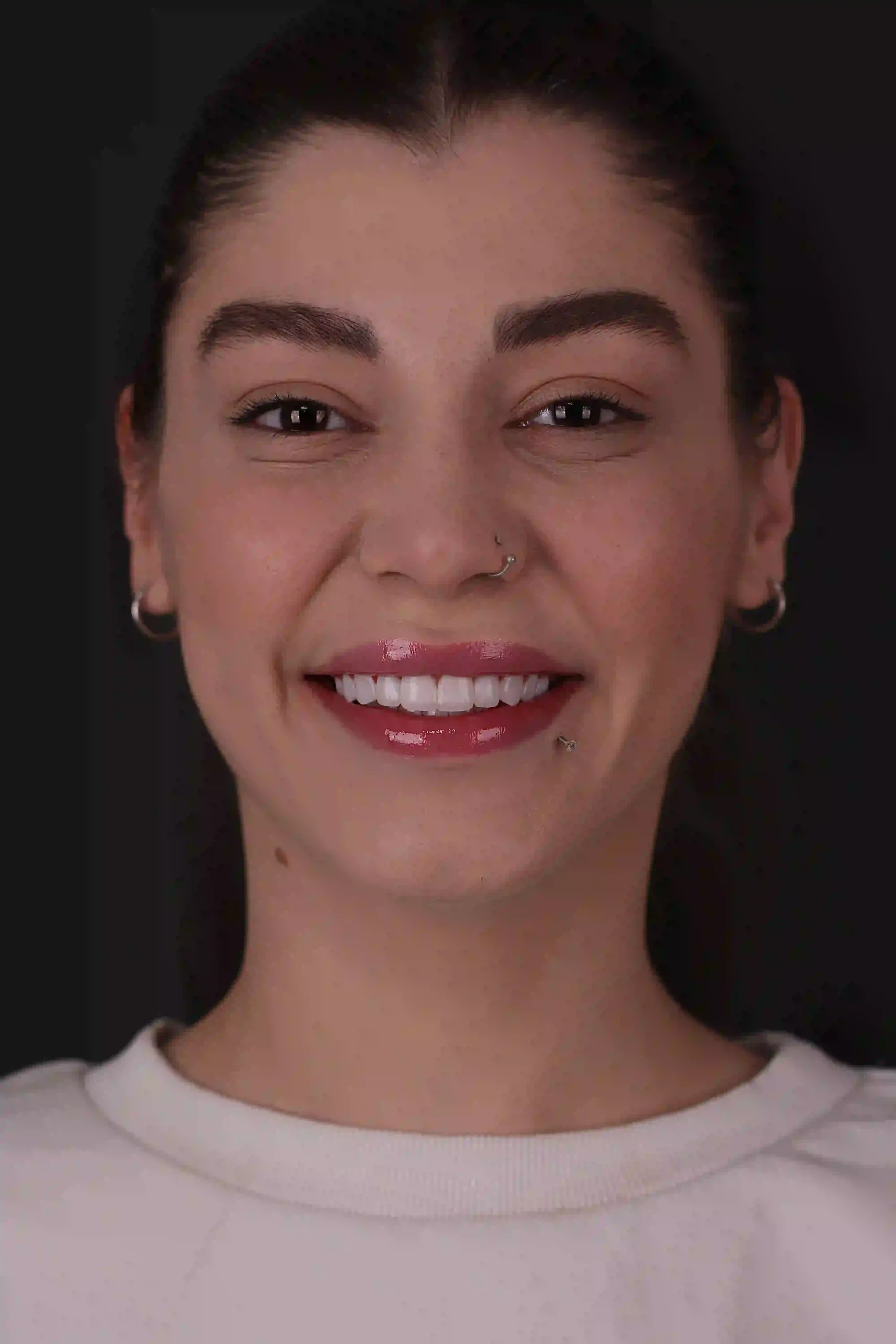 after composite 2