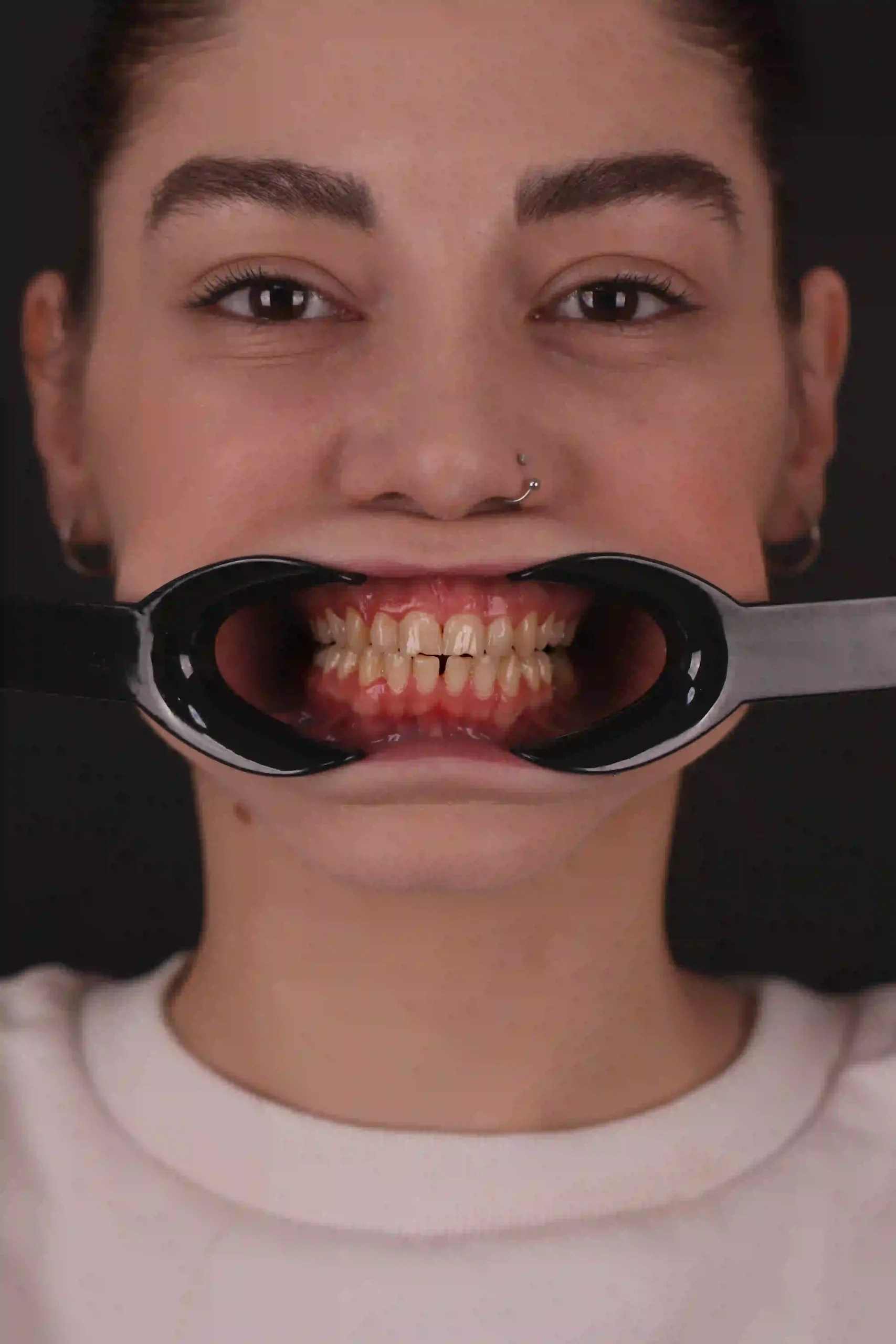 before composite 2